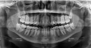 radiología digital - clínica dental en sevilla - centro bucodental